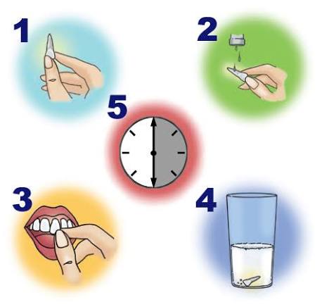Knocked-Out Tooth: Emergency Steps to Save It