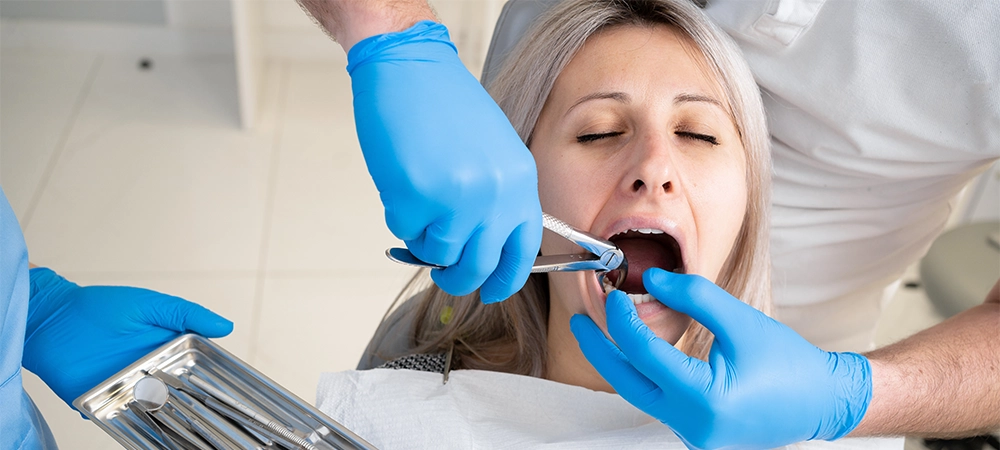 Tooth Extraction Cost in Toronto 2026: Simple, Surgical & Wisdom Teeth