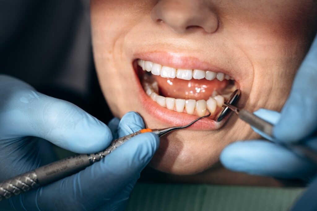 Broken Tooth: When to See an Emergency Dentist