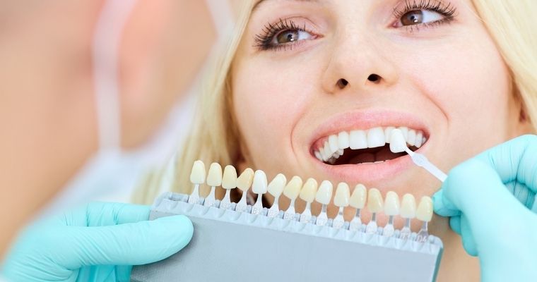 How Much Does Teeth Whitening Cost in Toronto? (2026 Guide)